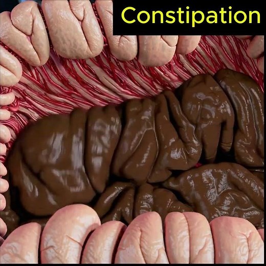 Slow Motion Constipated Stool Exit – Human Anatomy | 127