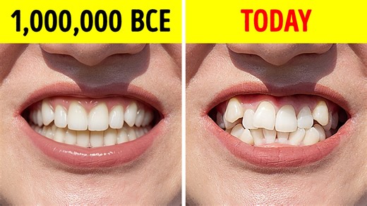 Why Early Humans Had Perfectly Straight Teeth