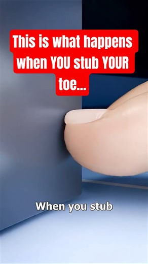 What happens when YOU stub YOUR toe... #shorts