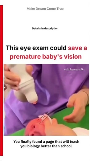 🤱 This eye exam could 👁️ save a premature baby's vision 🧑🏻‍⚕️ | MDCT