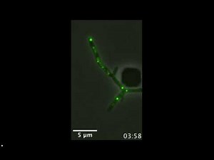 A Pitt lab shows phage attacks in new light