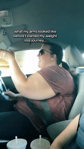 37K views · 337 reactions | loose skin & weight loss, let’s talk...