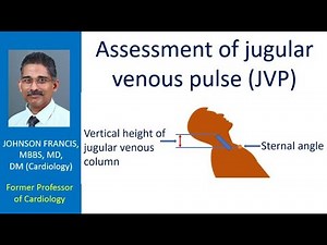 Assessment of jugular venous pulse (JVP)