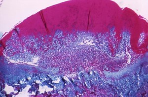 This Day in Science History - Edward Jenner & The Smallpox Vaccine | Immunology