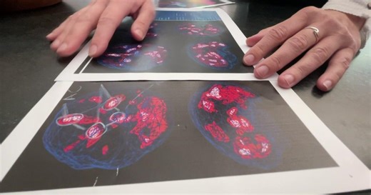 How a digital detox impacted Del Oro's softball team