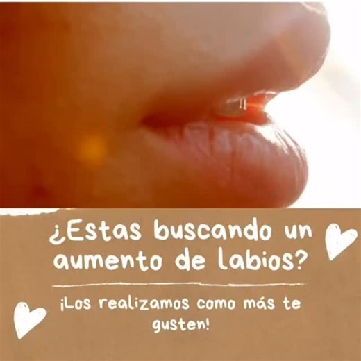 ¿Qué es Restylane Kysse? Es un ácido hialurónico (AH) reticulado con tecnología XpresHAn™️ (también llamada OBT – Optimal Balance Technology), que permite un resultado más flexible, natural y expresivo, ideal para labios que se mueven mucho. ¿Para qué se usa? Aumentar volumen labial. Mejorar la forma y el contorno. Definir el arco de Cupido. Corregir asimetrías. Atenuar líneas finas alrededor de los labios. ¿Cuánto dura? Aproximadamente 9 a 12 meses, dependiendo del metabolismo del paciente y la
