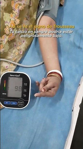 🩺 El Signo de Trousseau: Cuando el cuerpo revela sus secretos #traumatología #dolor