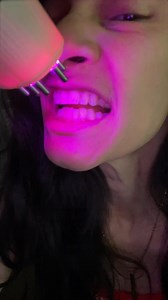 5.2K reactions · 1.1K shares | Diy teeth #teeth #dental #dentistry | Bianca Ruehlig | Facebook