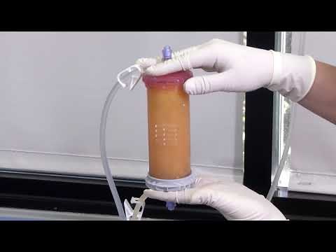 Lipogems: Best Processing Video