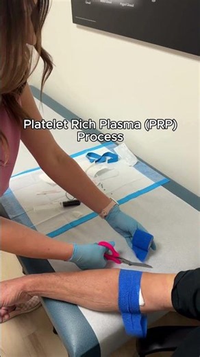 PRP, or Platelet Rich Plasma Process