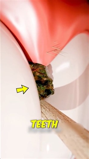 Why You Should Think Twice Before Using Toothpicks! 😱🦷