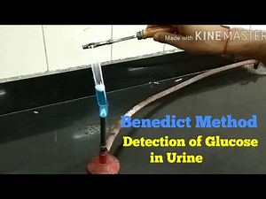 sugar test in urine by benedict method | sugar in urine
