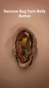 260K views · 902 reactions | Remove Bug from Belly Button ASMR Animationㅣ #reels #trending #reel #shorts #short #health | Akhilesh Yadav | Facebook