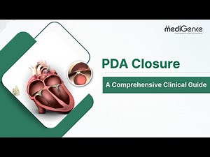 PDA Closure Explained | Success Rate, Treatment & Recovery Guide