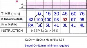 1K views · 48 reactions | Oxygen Measurements on the ABG...