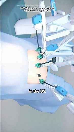 Robot Assisted Prostatectomy Surgery 3D Animation
