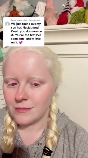 Understanding Nystagmus in Albinism: Facts and Causes