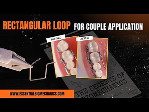 Rectangular_Loop_for_Couple_Application | Essential Biomechanics
