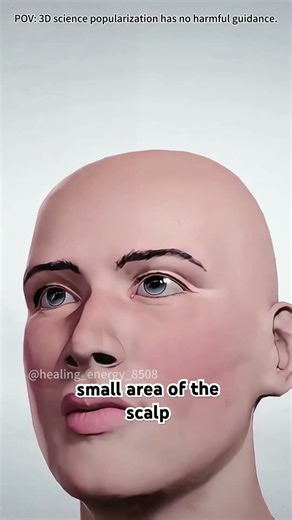 How craniotomy surgery is performed #drone #doctor #shockwavetherapy