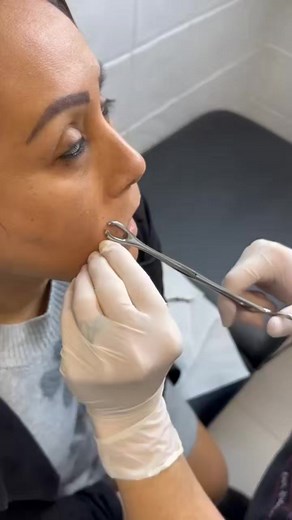 Piercing Madonna . . . #studiotattoo #studiotattoosevilla #piercer #piercingsevilla #gotikapiercing #lovepiercing #body #bodypiercings #piercingmadonna #madonnapiercing #madonnafans #madona #madonnaforever #sevilla #gotika #piercing #labret #labretpeircing @@tattoogotika