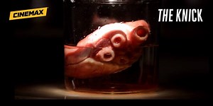 The Knick returns in TWO MONTHS. Relive the first season for a limited time only on #HBONOW and HBO GO. http://itsh.bo/HBONow | The Knick