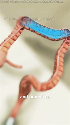 How Is Colon Hydrotherapy Performed( (3D Animation)#colonhydrotherapy #intestinalirrigation