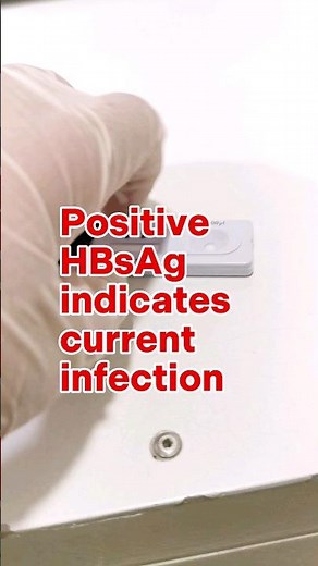 Hepatitis B Screening test #laboratory #medtechstudent #cls #mls #hepab
