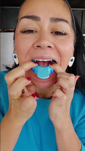Online Partial Dentures are Easy and Affordable