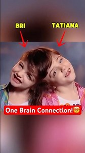 The Twins Who Can Feel Each Other’s Senses!