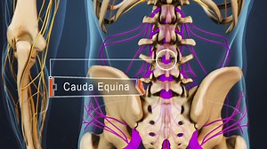 Spinal Cord and Cauda Equina of the Lumbar Spine