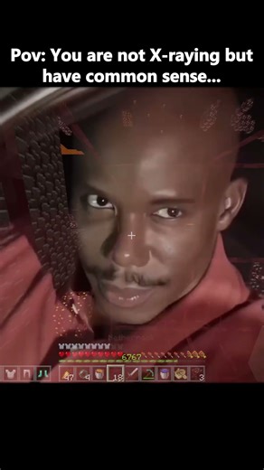 POV You’re not X raying, you just have common sense
