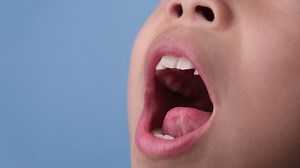 Close-up inside the oral cavity of a healthy child with beautiful rows of baby teeth. Young girl opens mouth revealing upper and lower teeth, hard palate, soft palate, dental and oral health checkup.