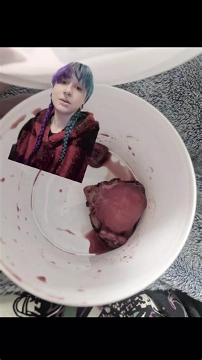 Exploring Uterus Anatomy Through Unique Perspectives