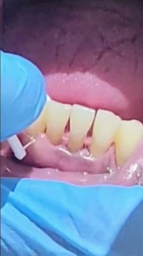 Comment utiliser la soie dentaire avec un manche