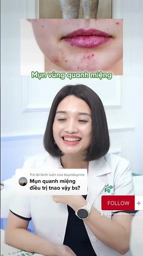 Mụn quanh miệng: Mách Bạn Cách Phân Biệt! #shorts #xuhuong #muntrungca