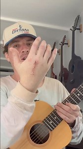 Guitar After Hand Surgery #sting #juicewrld #acousticguitar #guitar #recoveryjourney