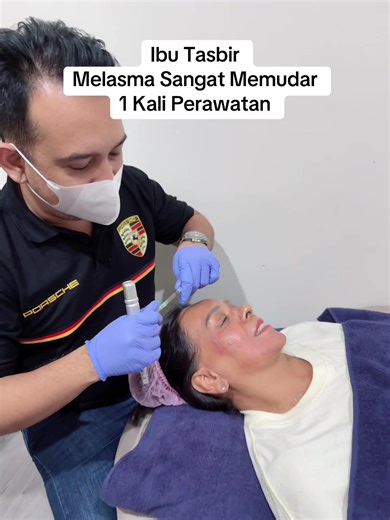 Cara Mengatasi Melasma dengan Skintifik dan Dokter Tompi