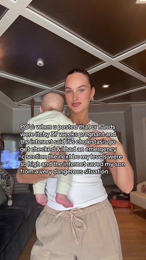Internet Saved My Son: Itchy Hands & Cholestasis
