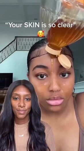 Here are the facts : Honey is antibacterial, antiseptic, hydrating , and also had anti inflammatory benefits . Honey can be applied directly on the skin as long as you don’t have a honey allergy. In that cause I would not recommend. Regular honey is okay. But what you want to use for skin purpose is Manuka Honey instead. Which is a higher grade honey and has healing properties. I rarely ever regimens applying things from your pantry on your face. But honey gets a pass because it’s actually bette