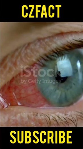 What is your eye colour | CzFact