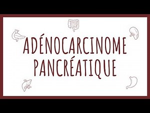 Sémiologie Pancréas - Adénocarcinome