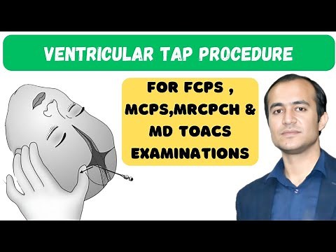 Ventricular Tap Procedure | Step-by-Step Guide for Doctors