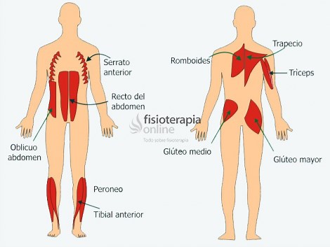 Músculos fásicos