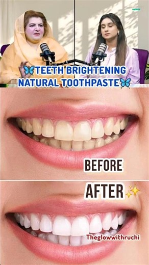 Natural Teeth Brightening Toothpaste🪥| DIY Coconut Oil for Whiter Teeth 🦷#teethwhitening #shorts