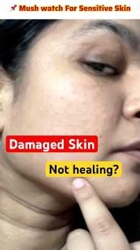 The ONLY Sensitive Skincare video You’ll ever need… Skin Barrier Health Explained #sensitiveskin