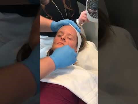 Illuminize peel by SkinMedica. Performed by Nick Miller.