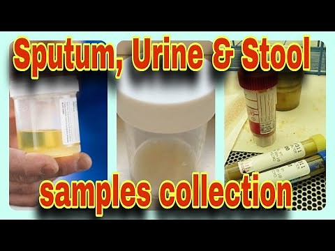 Stool, sputum urine Specimen collection| E-Learn with Zakir