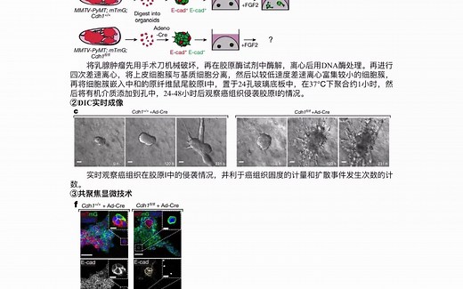 文献分享E-cadherin与乳腺癌细胞侵袭、转移
