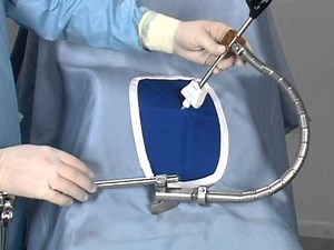 Thompson Retractor - Laparoscopy