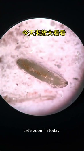 1000X Magnification: Seeing Rotten Banana Under Microscope